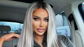 Intervenția estetică pe care Bianca Drăgușanu o regretă. Le îndeamnă pe femei să nu o facă: „Nu există niciun lucru mai prostesc”